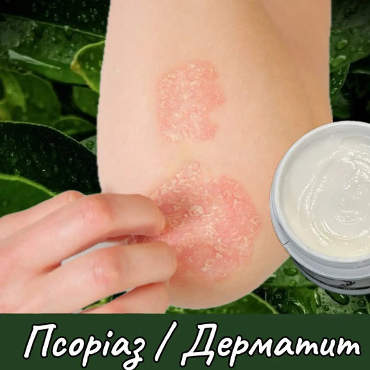 Бальзам для допомоги при ПСОРІАЗІ І ДЕРМАТИТАХ 30мл